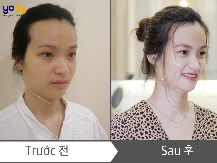 mặt vuông chữ điền